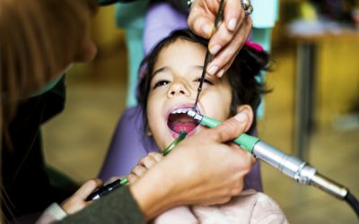 Las caries en niños con dientes de leche.