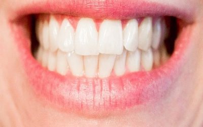 ¿Sabías que los dientes blancos no existen?